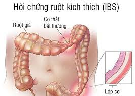 Các bệnh về đường tiêu hóa thường gặp – Nguyên nhân và triệu chứng nhận biết
