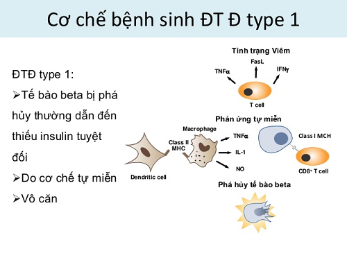 ĐÁI THÁO ĐƯỜNG TUÝP 1: NGUYÊN NHÂN, TRIỆU CHỨNG, CHẨN ĐOÁN VÀ ĐIỀU TRỊ