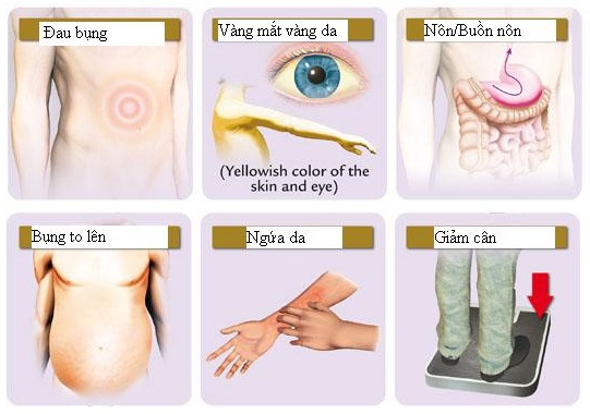 Căn bệnh ung thư gan - Nỗi lo của xã hội. TALKSHOW HỎI NHANH CÙNG DROH - ĐỂ CÓ LÁ GAN KHỎE