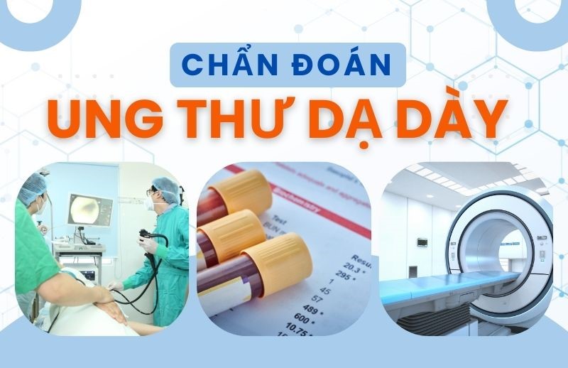 Ung thư dạ dày nguyên nhân, triệu chứng và chẩn đoán