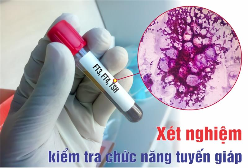 Dấu hiệu nhận biết các bệnh tuyến giáp