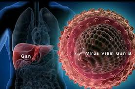 Viêm Gan B: Kẻ Giết Người Thầm Lặng Đang Ẩn Trong Cơ Thể Bạn?