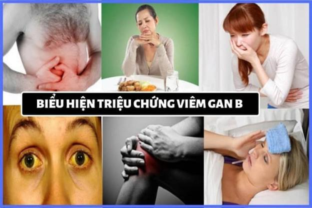 Viêm Gan B: Kẻ Giết Người Thầm Lặng Đang Ẩn Trong Cơ Thể Bạn?