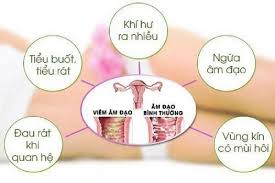 Viêm Âm Đạo — Bệnh Phụ Khoa Phổ Biến Nhưng Dễ Gây Biến Chứng Nguy Hiểm Nếu Chủ Quan!